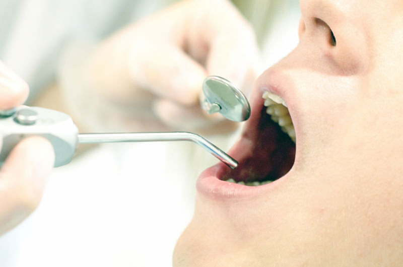 歯科口腔外科とは