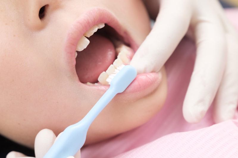 ブラッシング指導