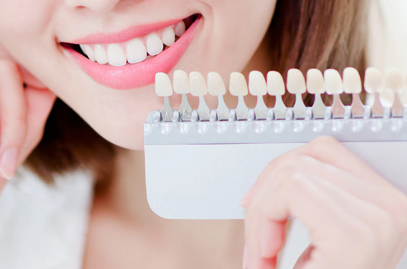 ホワイトニングとは